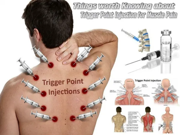 Things worth Knowing about Trigger Point Injection for Muscle Pain