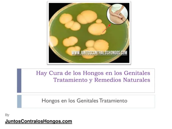 Hay cura de los hongos en los genitales tratamiento y remedios naturales