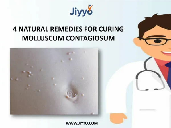 4 Natural Remedies For Curing Molluscum Contagiosum
