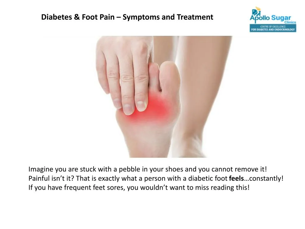 diabetes foot pain symptoms and treatment
