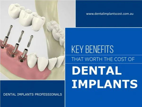 Dental Implant Cost in Sydney – Key Factors!
