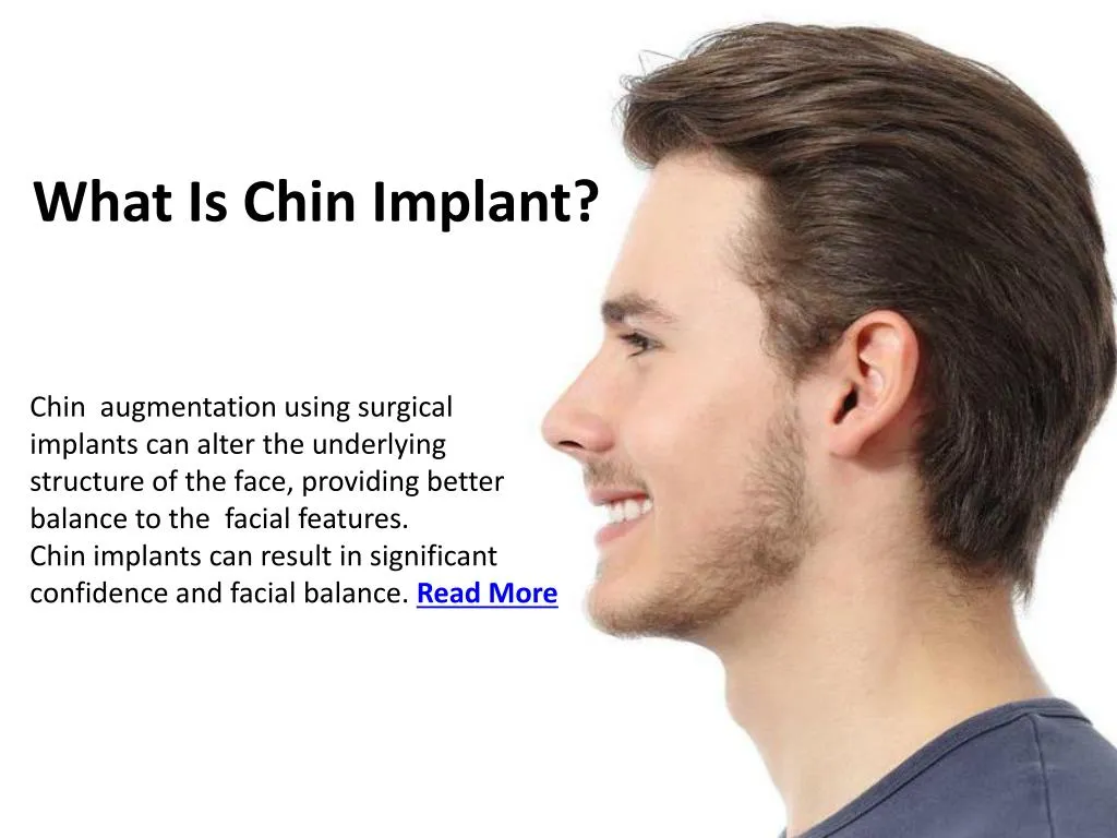what is chin implant
