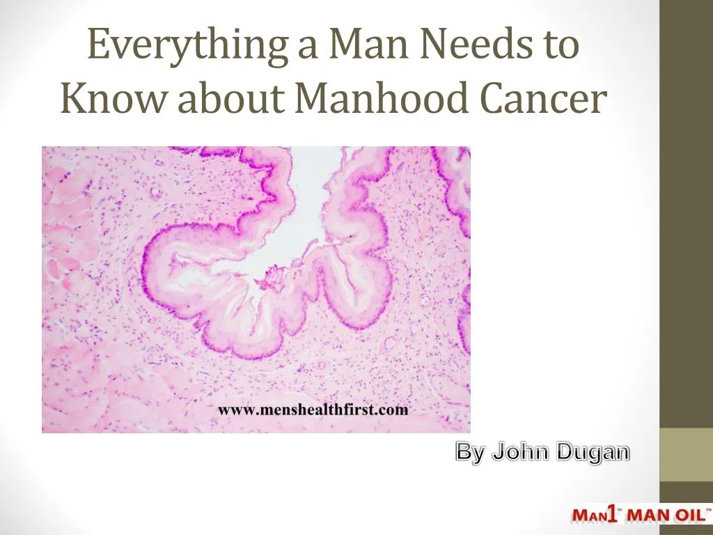 everything a man needs to know about manhood cancer