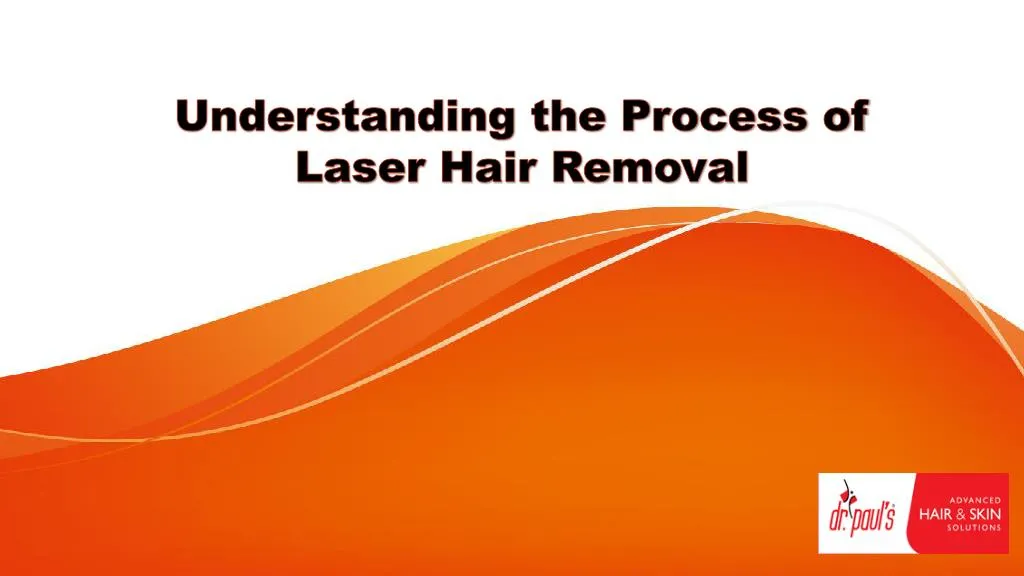 understanding the process of laser hair removal