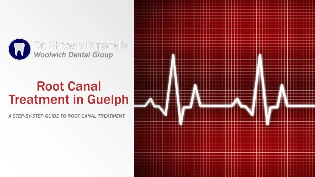 root canal treatment in guelph