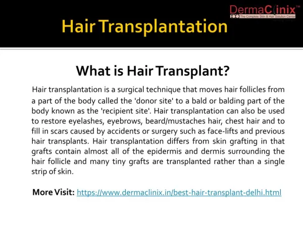 About Hair Transplantation