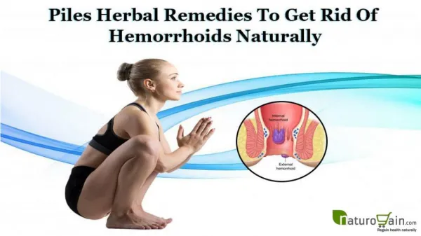 Piles Herbal Remedies to Get Rid of Hemorrhoids Naturally
