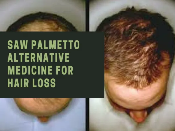Saw Palmetto Shampoo with Natural Extracts