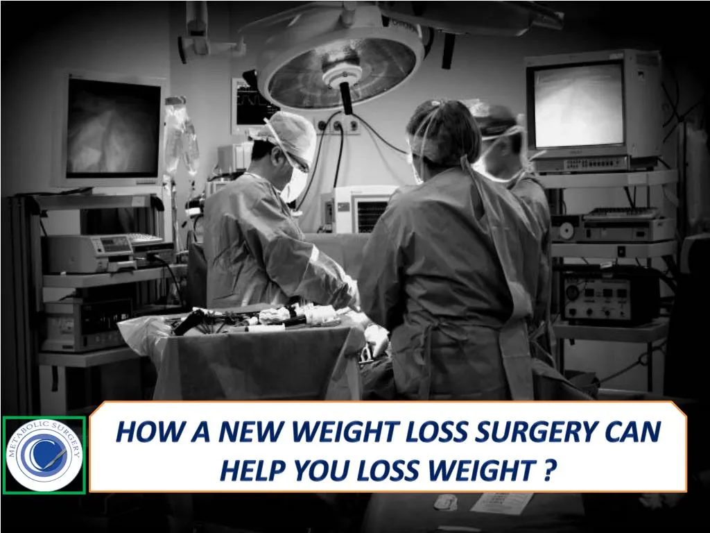 how a new weight loss surgery can help you loss