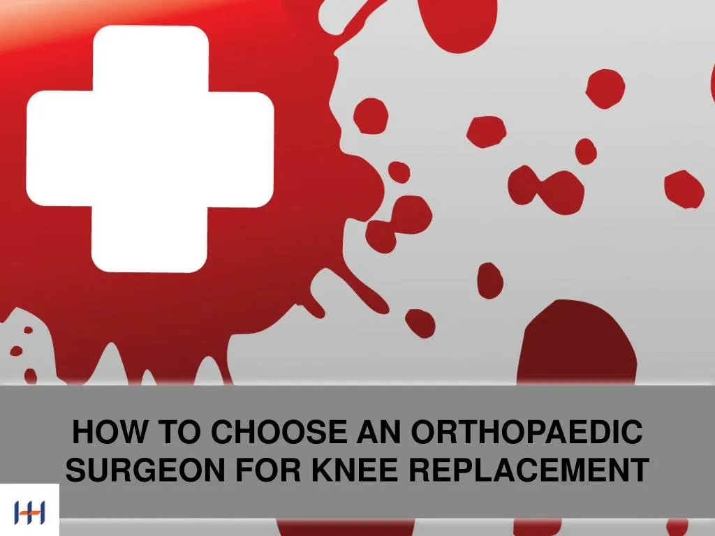 how to choose an orthopaedic surgeon for knee