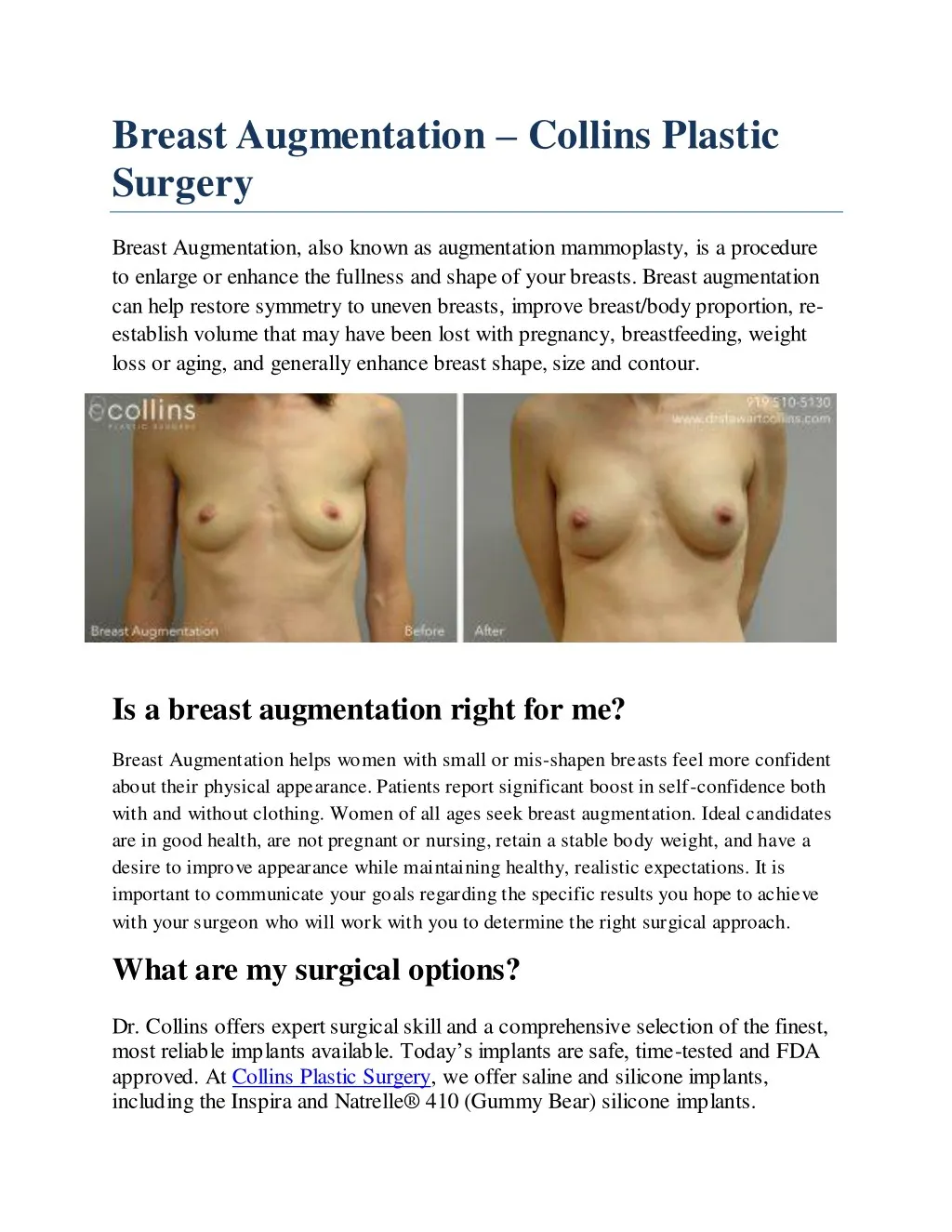 breast augmentation collins plastic surgery