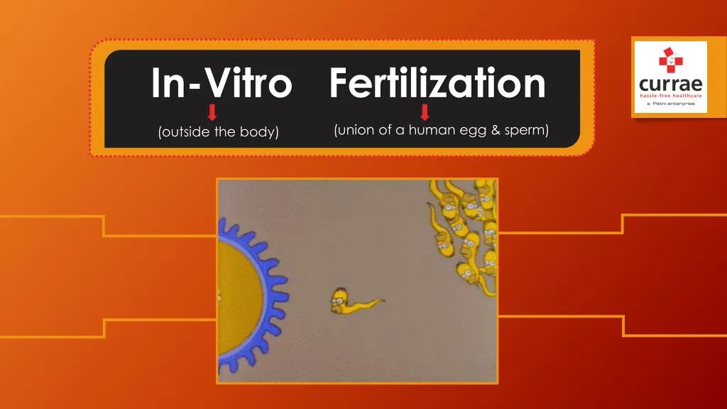 i n vitro fertilization