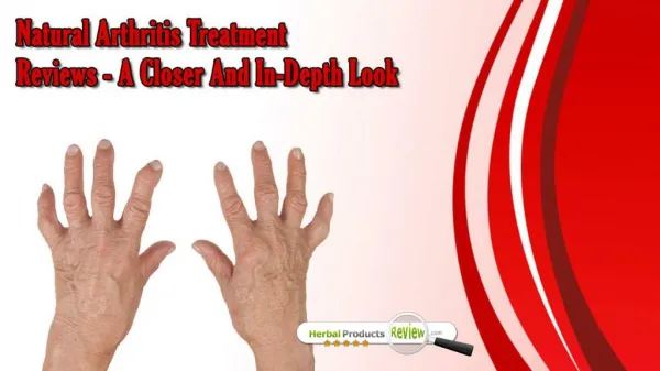 Natural Arthritis Treatment Reviews - A Closer and In-Depth Look