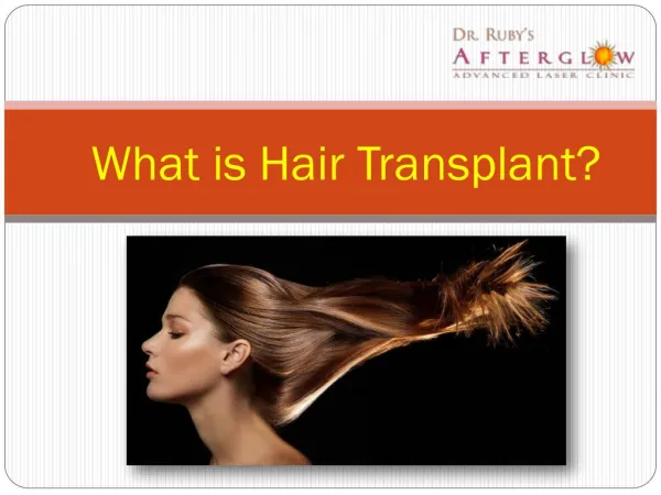 What is hair transplant?