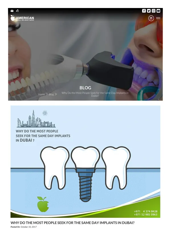 Dental Services in Dubai