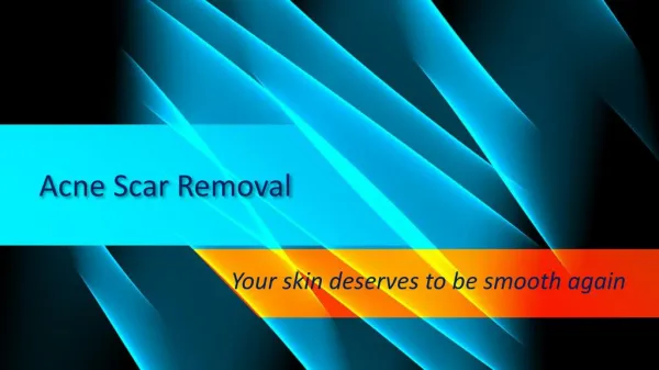 Acne Scar Removal - Guide to Treating Acne Scars