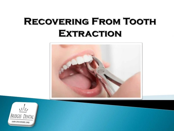 Lithia Dentist -Tooth extraction Aftercare & Recovery Tips | Bridges Dental