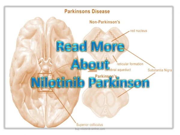 Read more about Nilotinib parkinson