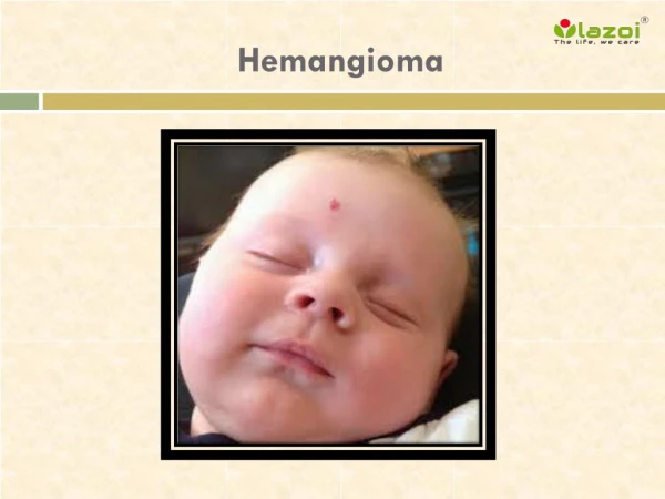 Hemangioma: Causes, Symptoms, Diagnosis and Treatment