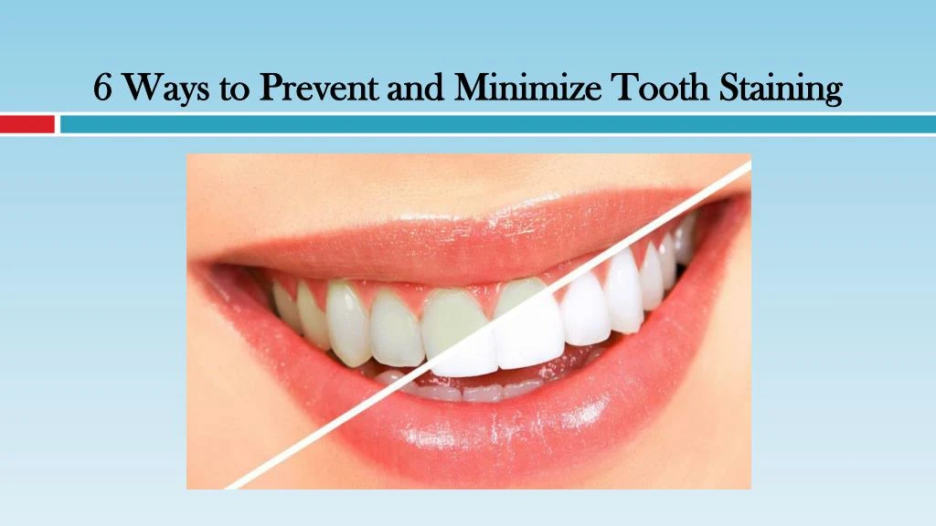 6 ways to prevent and minimize tooth staining