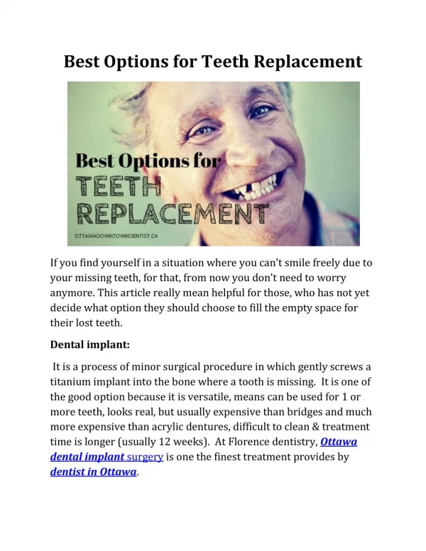 Best Options for Teeth Replacement