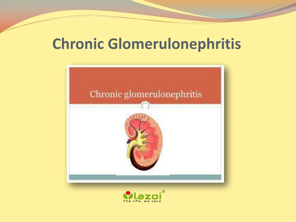 Ppt Chronic Glomerulonephritis Symptoms Causes And Treatment Powerpoint Presentation Id 