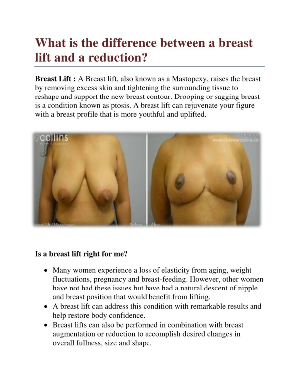What is the difference between a breast lift and a reduction?