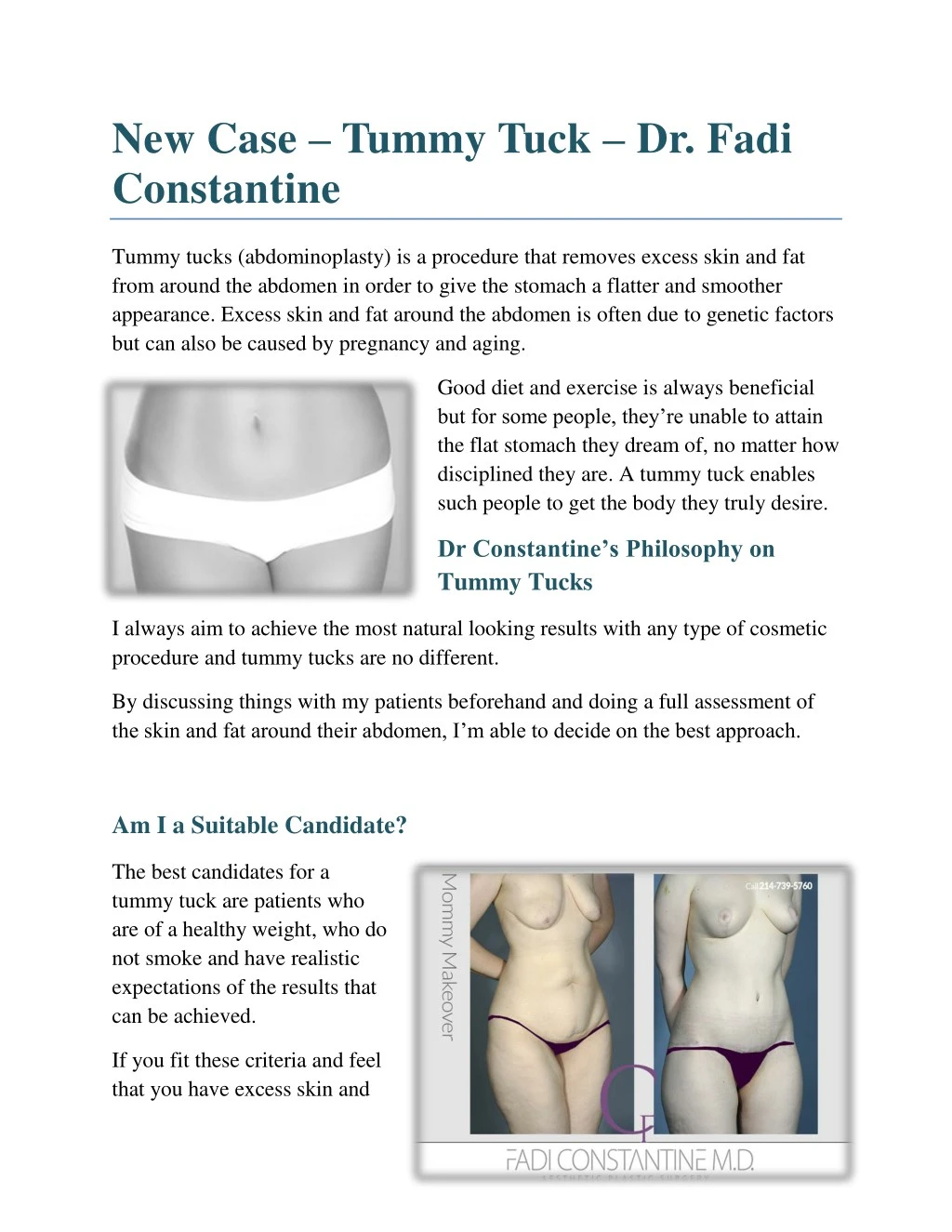 new case tummy tuck dr fadi constantine