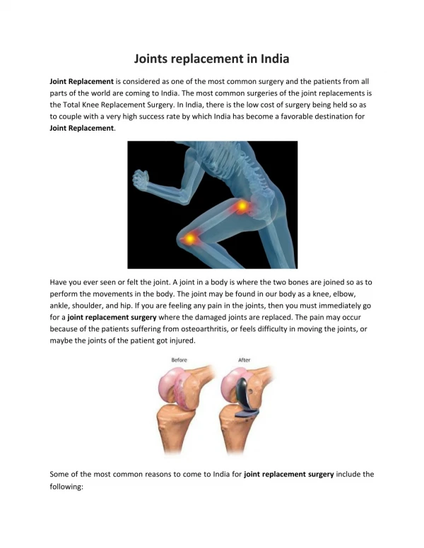 Joints replacement in india