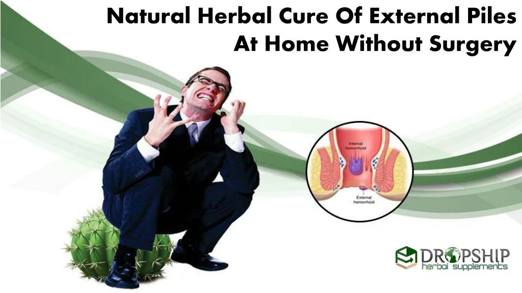 natural herbal cure of external piles at home