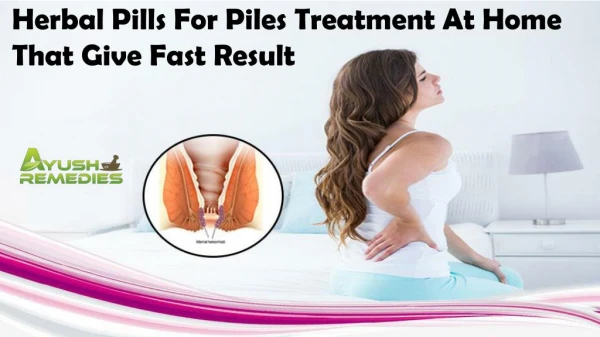 Herbal Pills for Piles Treatment at Home That Give Fast Result