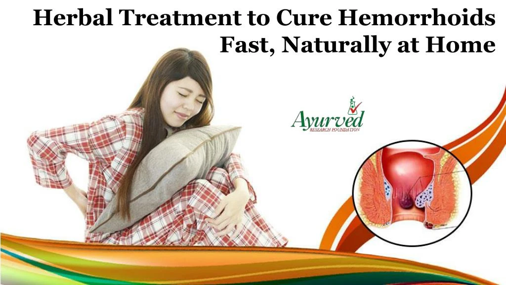 herbal treatment to cure hemorrhoids fast
