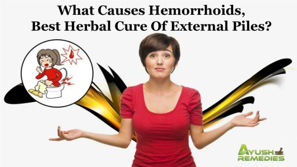 What Causes Hemorrhoids, Best Herbal Cure of External Piles?