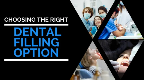 Choosing the Right Dental Filling Option