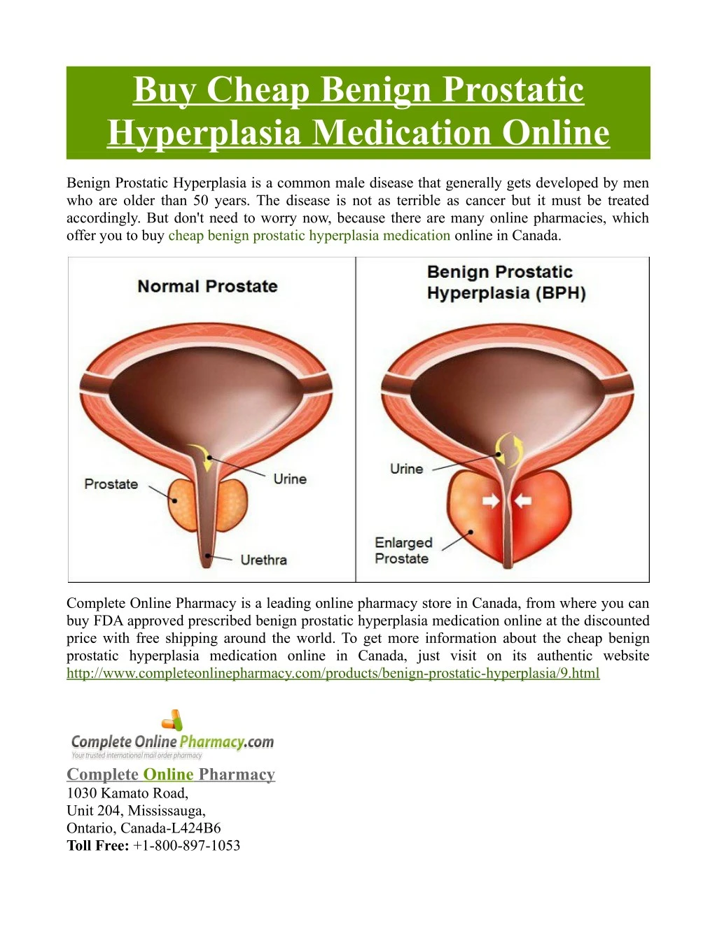 buy cheap benign prostatic hyperplasia medication