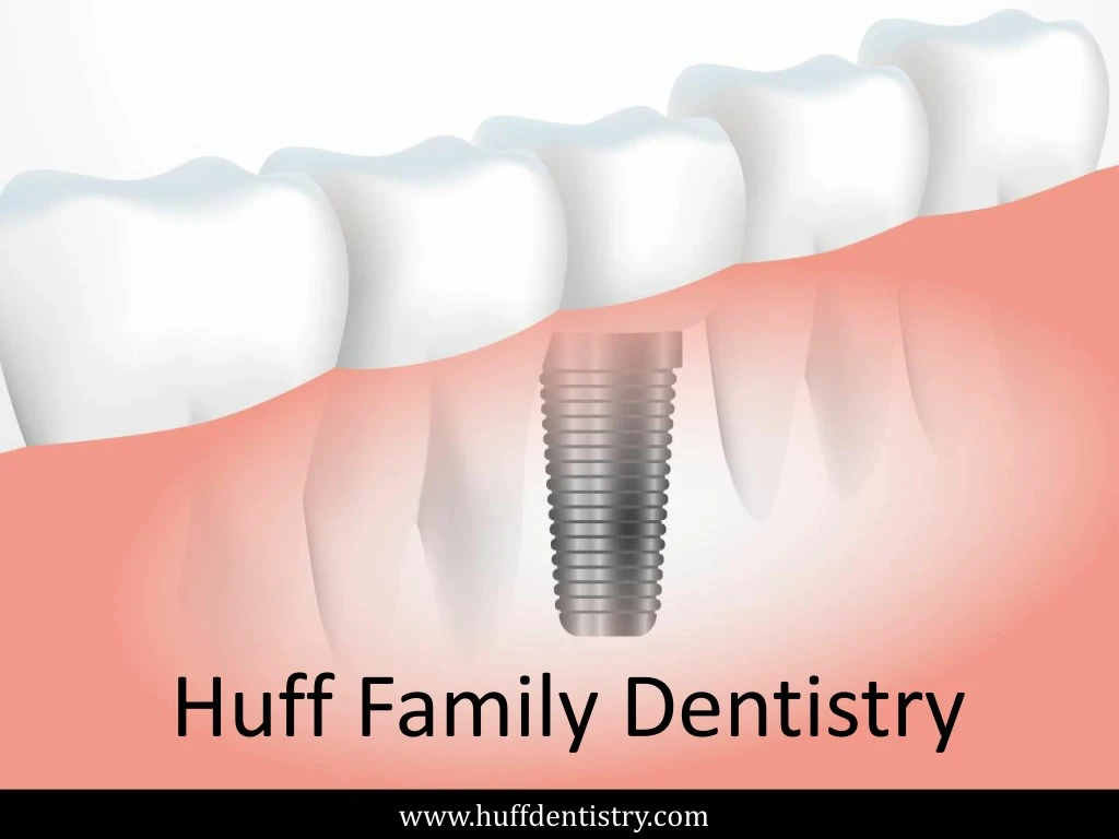 huff family dentistry