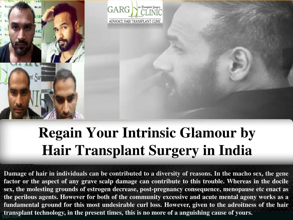 regain your intrinsic glamour by hair transplant surgery in india