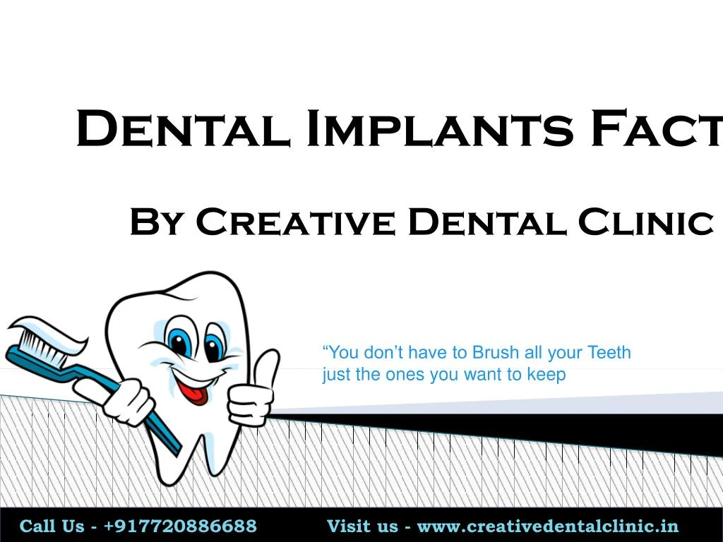 dental implants facts
