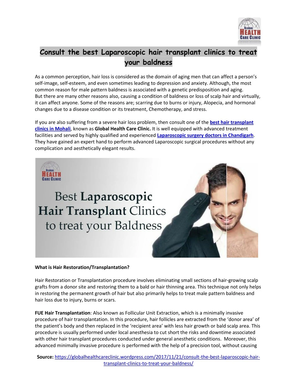 consult the best laparoscopic hair transplant