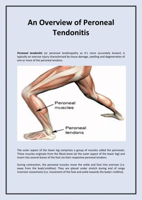 An Overview of Peroneal Tendonitis