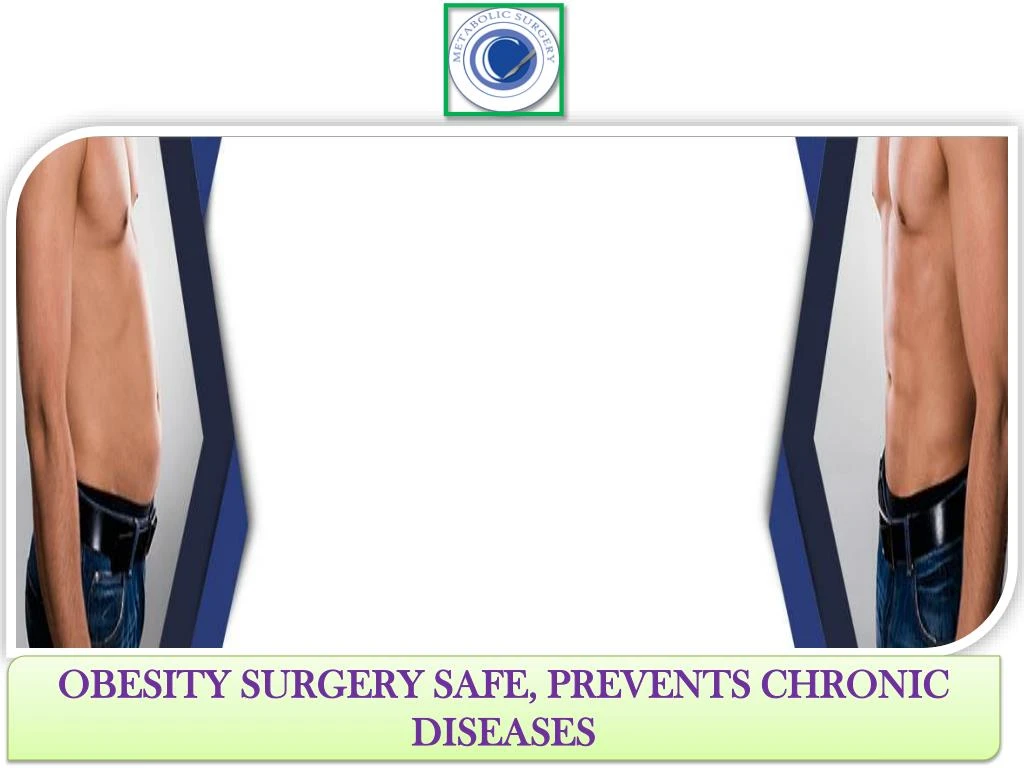 obesity surgery safe prevents chronic diseases