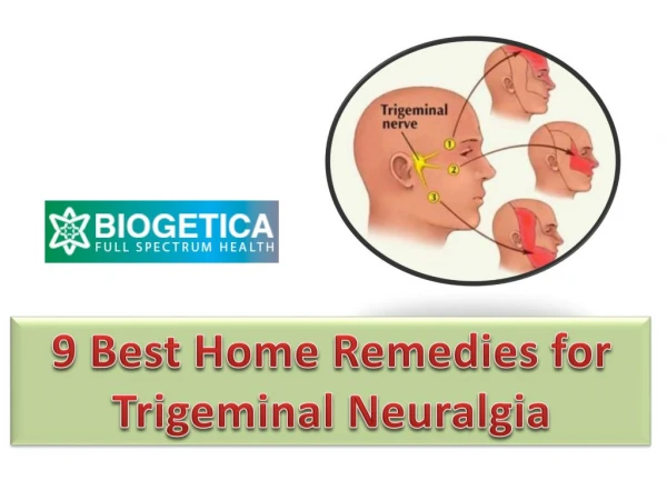 9 Best Home Remedies for Trigeminal Neuralgia - Biogetica