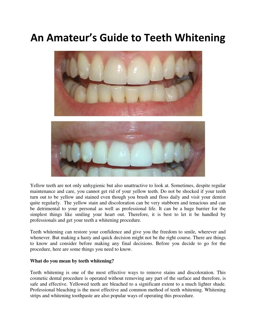 an amateur s guide to teeth whitening