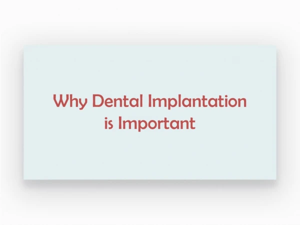 Why Dental Implantation is Important