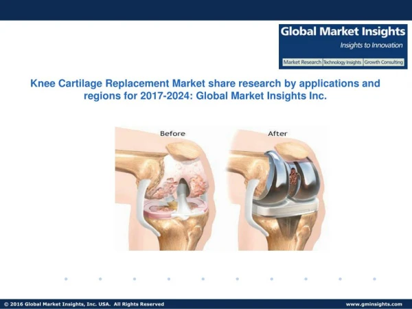 Knee Cartilage Replacement Market trends research and projections for 2017-2024