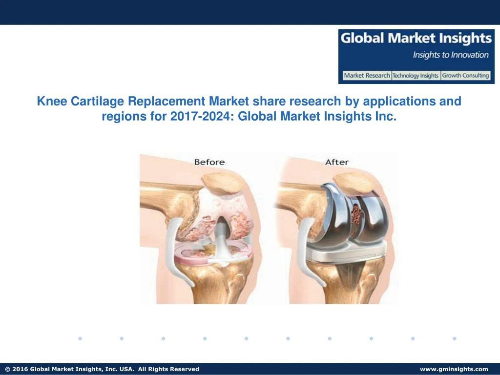 knee cartilage replacement market share research