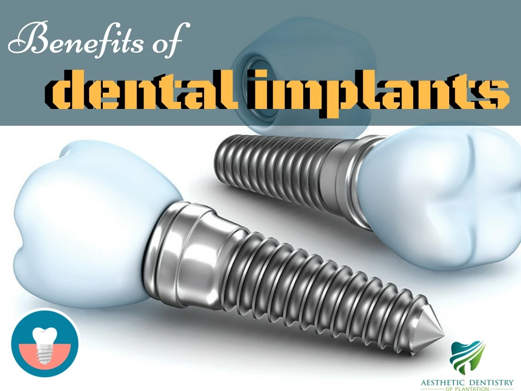 benefits of dental implants dental implants