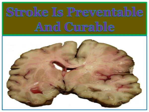 Stroke Is Preventable And Curable