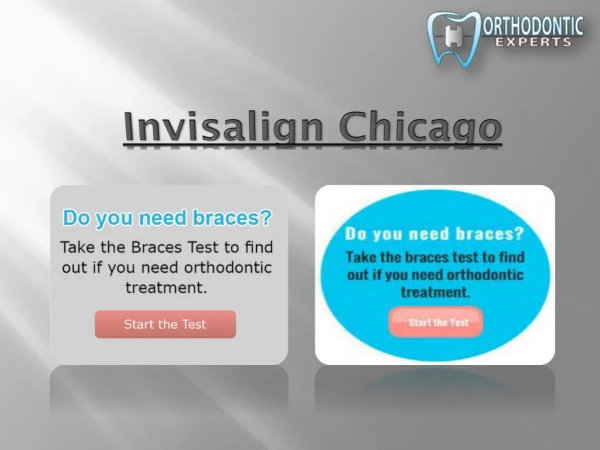 Best Braces in Chicago
