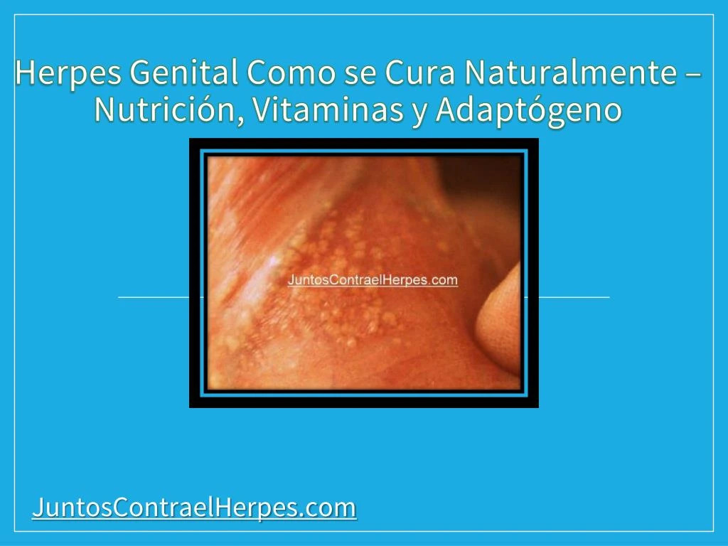 herpes genital como se cura naturalmente nutrici n vitaminas y adapt geno